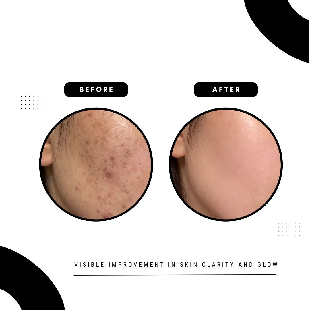 Clear Radiance Serum - Aura Plus